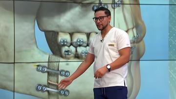 Oído, boca y nariz